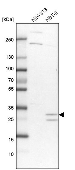 Invitrogen TOLLIP Polyclonal Antibody 100 &mu;L | Buy Online | Invitrogen&trade; | Fisher Scientific