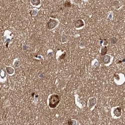 Invitrogen TOLLIP Polyclonal Antibody 100 &mu;L; Unconjugated:Antibodies,