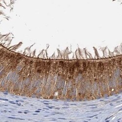 Invitrogen TOLLIP Polyclonal Antibody 100 &mu;L; Unconjugated:Antibodies,