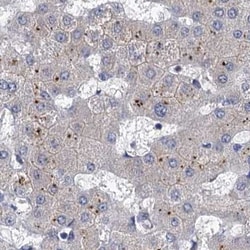 Invitrogen TOLLIP Polyclonal Antibody 100 &mu;L; Unconjugated:Antibodies,