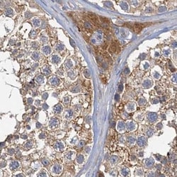 Invitrogen TOLLIP Polyclonal Antibody 100 &mu;L; Unconjugated:Antibodies,