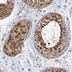 Invitrogen p23 Polyclonal Antibody 100 &mu;L; Unconjugated:Antibodies,