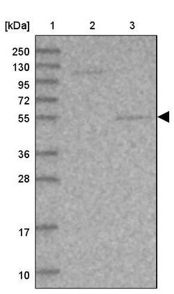 Invitrogen SRPX2 Polyclonal Antibody 100 &mu;L; Unconjugated:Antibodies,