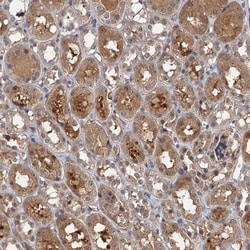 Invitrogen SNX15 Polyclonal Antibody 100 &mu;L; Unconjugated:Antibodies,