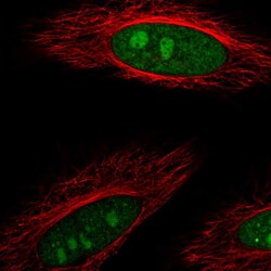 Invitrogen DDX23 Polyclonal Antibody 100 &mu;L; Unconjugated:Antibodies,