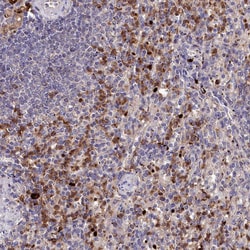 Invitrogen KLRB1 Polyclonal Antibody 100 &mu;L; Unconjugated:Antibodies,