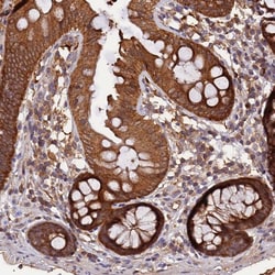 Invitrogen MARK4 Polyclonal Antibody 100 &mu;L; Unconjugated:Antibodies,