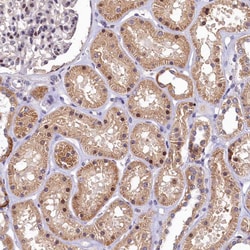 Invitrogen LATS2 Polyclonal Antibody 100 &mu;L; Unconjugated:Antibodies,