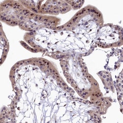 Invitrogen LATS2 Polyclonal Antibody 100 &mu;L; Unconjugated:Antibodies,
