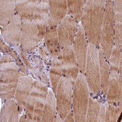 Invitrogen LATS2 Polyclonal Antibody 100 &mu;L; Unconjugated:Antibodies,