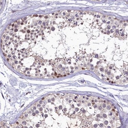 Invitrogen LATS2 Polyclonal Antibody 100 &mu;L; Unconjugated:Antibodies,