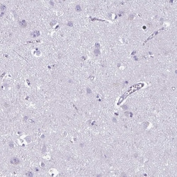 Invitrogen PLCB3 Polyclonal Antibody 100 &mu;L; Unconjugated:Antibodies,