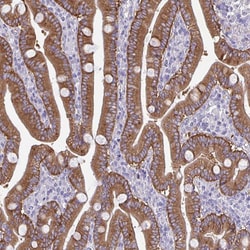 Invitrogen PLCB3 Polyclonal Antibody 100 &mu;L; Unconjugated:Antibodies,