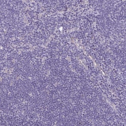Invitrogen PLCB3 Polyclonal Antibody 100 &mu;L; Unconjugated:Antibodies,