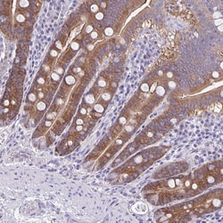Invitrogen PLCB3 Polyclonal Antibody 100 &mu;L; Unconjugated:Antibodies,