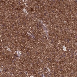 Invitrogen DNM1L Polyclonal Antibody 100 &mu;L; Unconjugated:Antibodies,