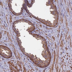 Invitrogen DNM1L Polyclonal Antibody 100 &mu;L; Unconjugated:Antibodies,