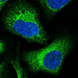 Invitrogen DNAJC3 Polyclonal Antibody 100 &mu;L; Unconjugated:Antibodies,