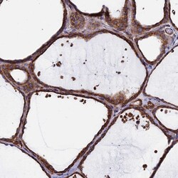 Invitrogen DNAJC3 Polyclonal Antibody 100 &mu;L; Unconjugated:Antibodies,