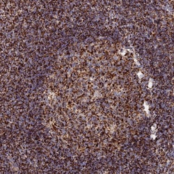 Invitrogen HICE1 Polyclonal Antibody 100 &mu;L; Unconjugated:Antibodies,