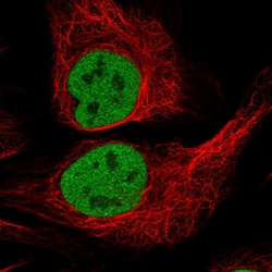 Invitrogen p70 S6 Kinase Polyclonal Antibody 100 &mu;L; Unconjugated:Antibodies,