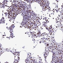 Invitrogen p70 S6 Kinase Polyclonal Antibody 100 &mu;L; Unconjugated:Antibodies,