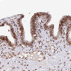 Invitrogen APC5 Polyclonal Antibody 100 &mu;L; Unconjugated:Antibodies,