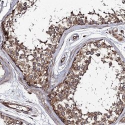 KIAA1524 Polyclonal Antibody, Invitrogen 100 &mu;L; Unconjugated:Antibodies,