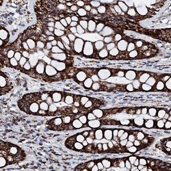 Invitrogen HADH Polyclonal Antibody 100 &mu;L; Unconjugated:Antibodies,