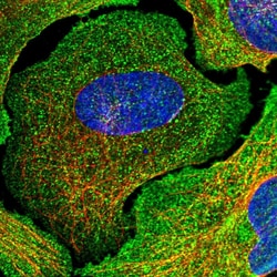 Invitrogen CD56 Polyclonal Antibody 100 &mu;L; Unconjugated:Antibodies,