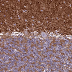 Invitrogen CD56 Polyclonal Antibody 100 &mu;L; Unconjugated:Antibodies,