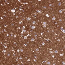Invitrogen CD56 Polyclonal Antibody 100 &mu;L; Unconjugated:Antibodies,