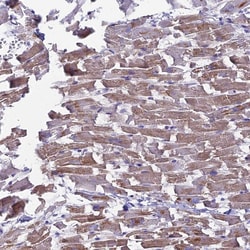 Invitrogen CD56 Polyclonal Antibody 100 &mu;L; Unconjugated:Antibodies,