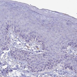 Invitrogen CD56 Polyclonal Antibody 100 &mu;L; Unconjugated:Antibodies,