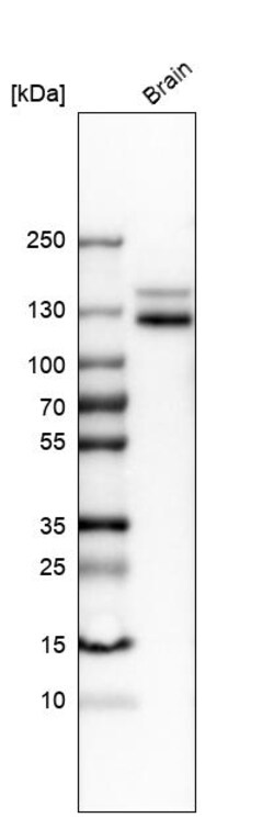 Invitrogen CD56 Polyclonal Antibody 100 &mu;L | Buy Online | Invitrogen&trade; | Fisher Scientific