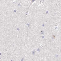 Invitrogen TXNDC6 Polyclonal Antibody 100 &mu;L | Buy Online | Invitrogen&trade; | Fisher Scientific