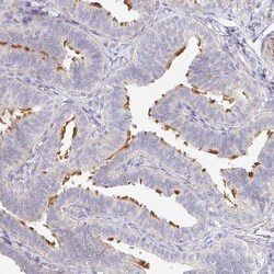 Invitrogen TXNDC6 Polyclonal Antibody 100 &mu;L | Buy Online | Invitrogen&trade; | Fisher Scientific