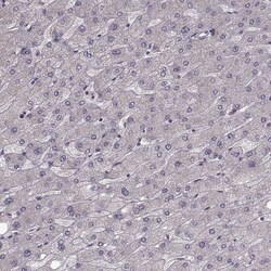 Invitrogen RHAMM Polyclonal Antibody 100 &mu;L | Buy Online | Invitrogen&trade; | Fisher Scientific
