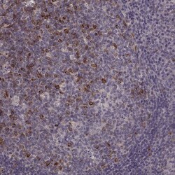 Invitrogen RHAMM Polyclonal Antibody 100 &mu;L | Buy Online | Invitrogen&trade; | Fisher Scientific