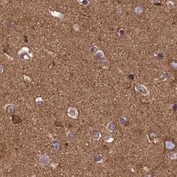 Invitrogen Dynactin 2 Polyclonal Antibody 100 &mu;L; Unconjugated:Antibodies,