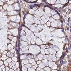 Invitrogen Dynactin 2 Polyclonal Antibody 100 &mu;L; Unconjugated:Antibodies,