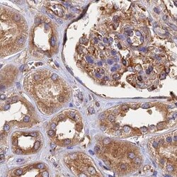 Invitrogen Dynactin 2 Polyclonal Antibody 100 &mu;L; Unconjugated:Antibodies,
