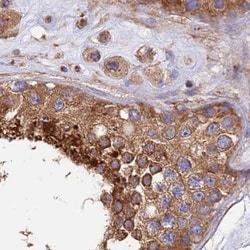Invitrogen Dynactin 2 Polyclonal Antibody 100 &mu;L; Unconjugated:Antibodies,
