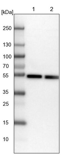 Invitrogen Dynactin 2 Polyclonal Antibody 100 &mu;L | Buy Online | Invitrogen&trade; | Fisher Scientific