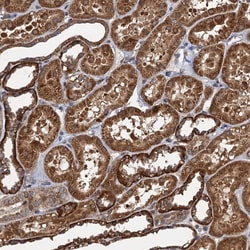Invitrogen NALP10 Polyclonal Antibody 100 &mu;L; Unconjugated:Antibodies,