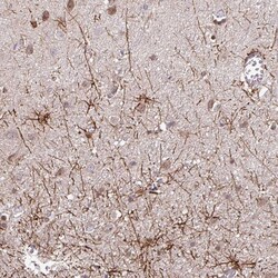 Invitrogen Glypican 5 Polyclonal Antibody 100 &mu;L; Unconjugated:Antibodies,