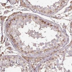 Invitrogen Glypican 5 Polyclonal Antibody 100 &mu;L; Unconjugated:Antibodies,