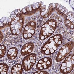 Invitrogen YBX1 Polyclonal Antibody 100 &mu;L; Unconjugated:Antibodies,