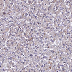 Invitrogen YBX1 Polyclonal Antibody 100 &mu;L; Unconjugated:Antibodies,