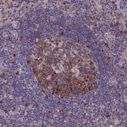 Invitrogen YBX1 Polyclonal Antibody 100 &mu;L; Unconjugated:Antibodies,